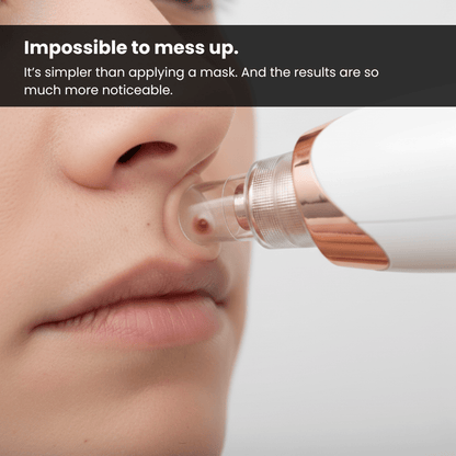 The Blackhead Remover Vacuum