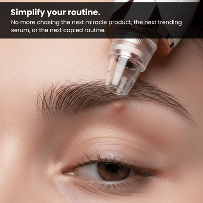 The Blackhead Remover Vacuum