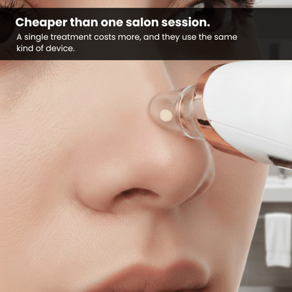 The Blackhead Remover Vacuum