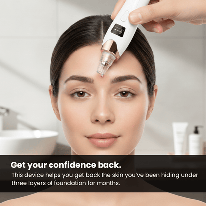 The Blackhead Remover Vacuum